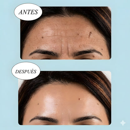 Antes y después